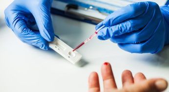 Covid – Parafarmacie escluse dai sierologici, è rivolta