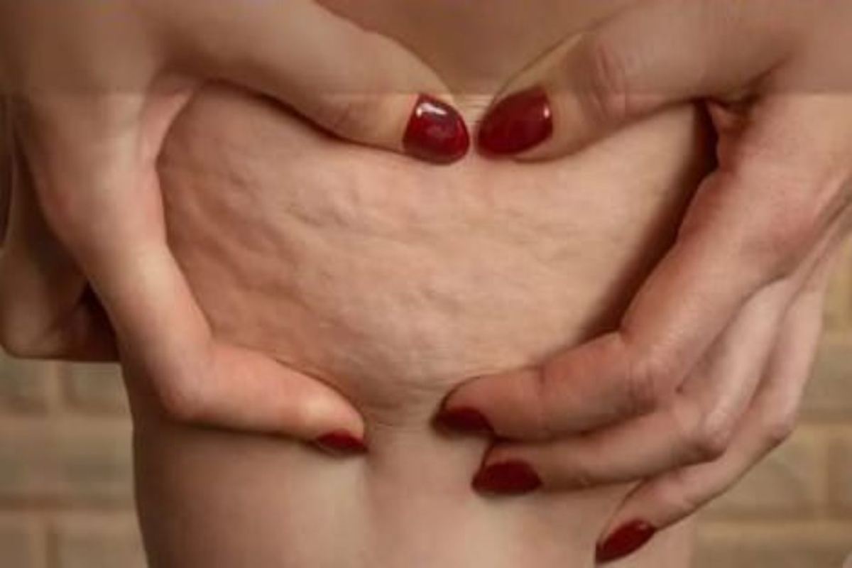 Cellulite cosa indossare per ridurla