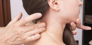 Cervicale